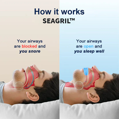 SEAGRIL™Professional intelligent anti-snoring device